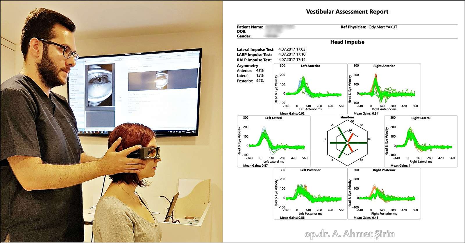 VHİT ( Video Head İmpulse test ) Opr. Doctor Ali Ahmet Şirin (ENT and